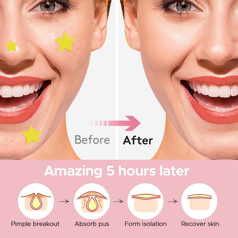600Pcs/set Star Pimple Patch A - Skincare 评论和价格